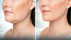 5 helppoa harjoitusta, jotka antavat ”kiristyneen kasvon” vaikutelman ilman kosmetologin apua – jo muutaman viikon kuluttua